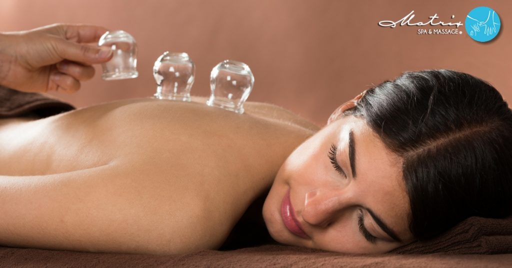 Cupping Treatment at Matrix Massage & Spa